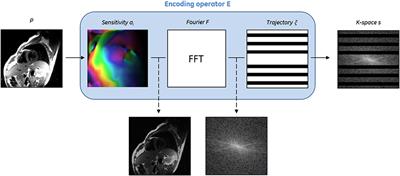 From Compressed-Sensing to Artificial Intelligence-Based Cardiac MRI Reconstruction